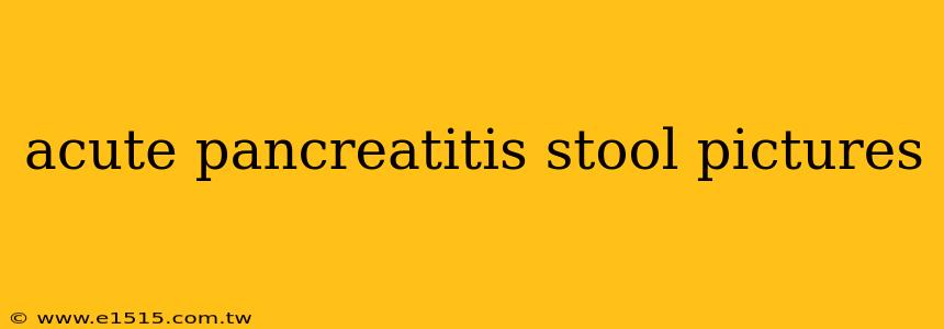 acute pancreatitis stool pictures