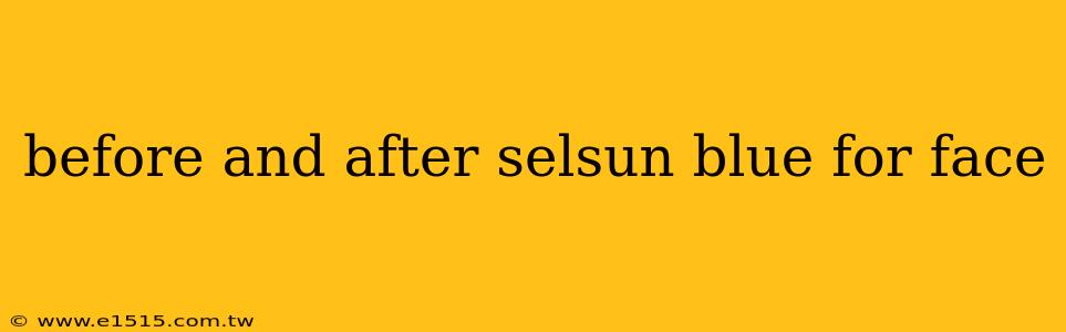 before and after selsun blue for face