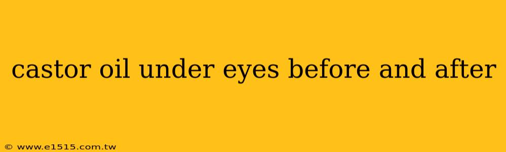 castor oil under eyes before and after