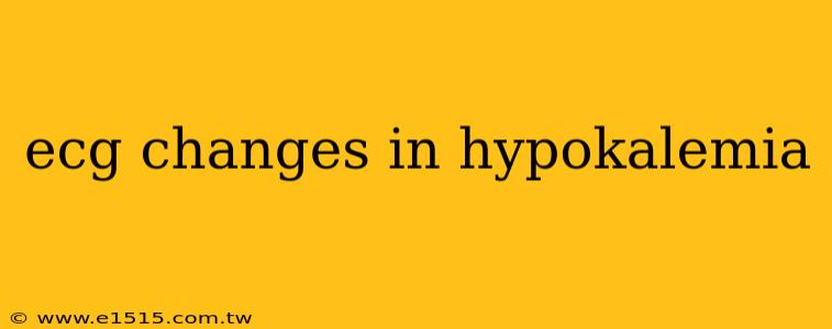 ecg changes in hypokalemia