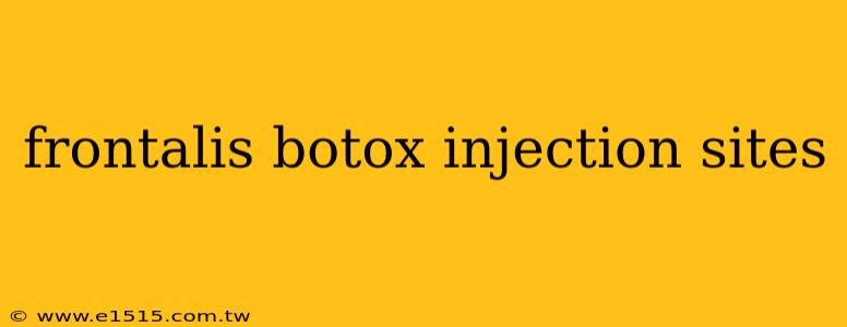 frontalis botox injection sites