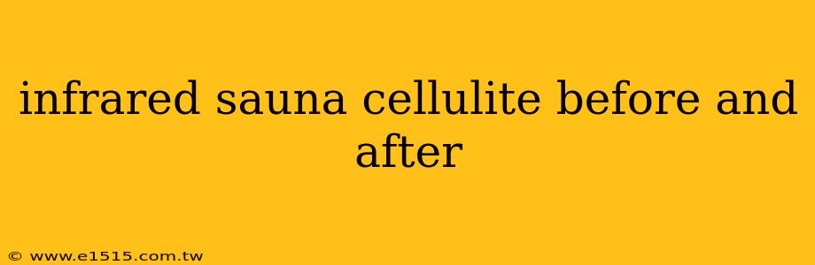 infrared sauna cellulite before and after