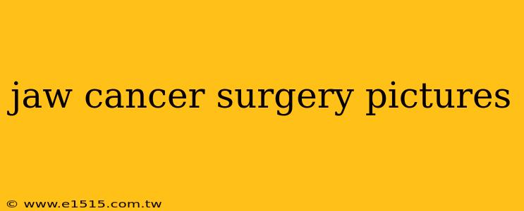 jaw cancer surgery pictures