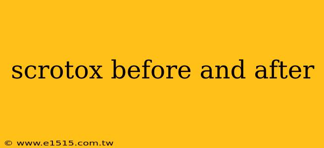 scrotox before and after