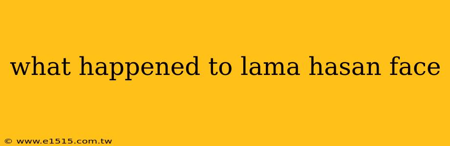 what happened to lama hasan face