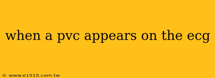 when a pvc appears on the ecg